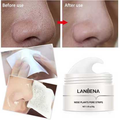 BLACKHEAD REMOVER LANBENA